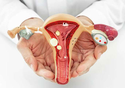 Gynecological Problems