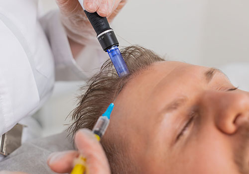 Hair Exosome Therapy
