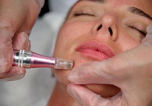 Face Exosome Therapy